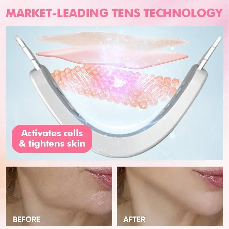 Portable Facial Lifting Slimming Device